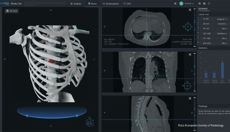 (Zdroj: European Society of Radiology)